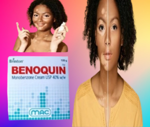 Benoquin Cream In Islamabad Karachi 