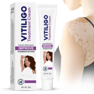  https://newtelebazer.com/product/vitigo-gel-50g-in-pakistan/